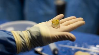 A gloved surgeons hand holds a small part. Blue surgery drapes are in the background.