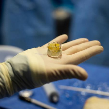 A gloved hand holds an artificial heart valve.  Blue surgical drapes are in the background.